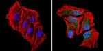 PKR Antibody in Immunocytochemistry (ICC/IF)