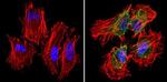 PKR Antibody in Immunocytochemistry (ICC/IF)