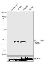 Huntingtin Antibody in Western Blot (WB)