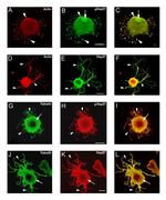 Phospho-HSP27 (Ser15) Antibody in Immunocytochemistry (ICC/IF)