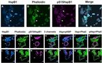 Phospho-HSP27 (Ser15) Antibody in Immunocytochemistry (ICC/IF)