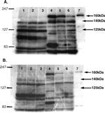 nNOS Antibody in Western Blot (WB)