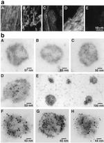 iNOS Antibody in Immunomicroscopy (IM)