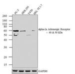 alpha-2a Adrenergic Receptor Antibody in Western Blot (WB)