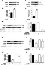 Leptin Antibody in Western Blot (WB)