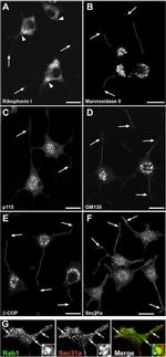 beta COP Antibody in Immunocytochemistry (ICC/IF)