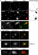 beta COP Antibody in Immunocytochemistry (ICC/IF)