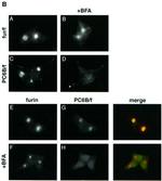 Furin Antibody in Immunocytochemistry (ICC/IF)