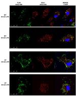 EEA1 Antibody in Immunocytochemistry (ICC/IF)