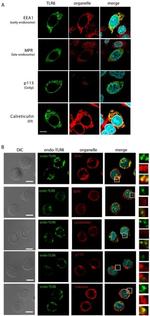 EEA1 Antibody in Immunocytochemistry (ICC/IF)