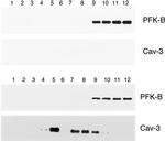 Caveolin 3 Antibody in Western Blot (WB)