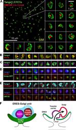 COPII Antibody in Immunocytochemistry (ICC/IF)