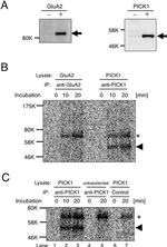 PICK1 Antibody in Western Blot, Immunoprecipitation (WB, IP)