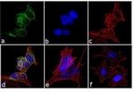 Phospho-Huntingtin (Ser421) Antibody in Immunocytochemistry (ICC/IF)