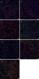 SOX2 Antibody in Immunohistochemistry (IHC)