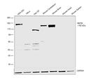 NEFM Antibody in Western Blot (WB)