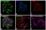 NEFM Antibody