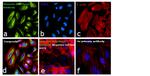 Vimentin Antibody