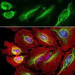 Vimentin Antibody in Immunocytochemistry (ICC/IF)