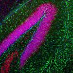 GFAP Antibody in Immunohistochemistry (Paraffin) (IHC (P))