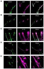 MBP Antibody in Immunohistochemistry (IHC)