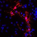 MBP Antibody in Immunocytochemistry (ICC/IF)