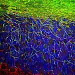 NEFL Antibody in Immunocytochemistry (ICC/IF)