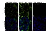 NEFM Antibody in Immunocytochemistry (ICC/IF)