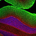 NEFM Antibody in Immunohistochemistry (Paraffin) (IHC (P))