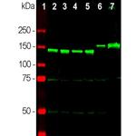 NEFM Antibody in Western Blot (WB)