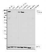 NEFM Antibody in Western Blot (WB)