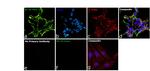 NEFM Antibody in Immunocytochemistry (ICC/IF)