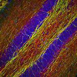 NF-H Antibody in Immunohistochemistry (Paraffin) (IHC (P))