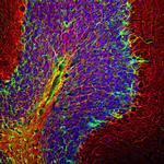 GFAP Antibody in Immunohistochemistry (Paraffin) (IHC (P))