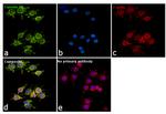 Coronin 1A Antibody in Immunocytochemistry (ICC/IF)