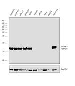 PGP9.5 Antibody in Western Blot (WB)