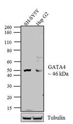 GATA4 Antibody in Western Blot (WB)