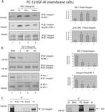 IRS1 Antibody in Western Blot (WB)