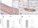 Androgen Receptor Antibody in Immunohistochemistry (IHC)