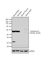 Calcineurin A Antibody in Western Blot (WB)