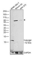 TYROBP Antibody in Western Blot (WB)