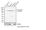 HIF-2 alpha Antibody