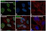 FANCD2 Antibody in Immunocytochemistry (ICC/IF)