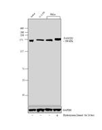 FANCD2 Antibody in Western Blot (WB)