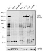 53BP1 Antibody in Western Blot (WB)