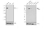 NEFM Antibody