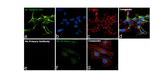 NEFM Antibody in Immunocytochemistry (ICC/IF)