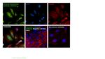 Vimentin Antibody in Immunocytochemistry (ICC/IF)