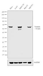 Vimentin Antibody in Western Blot (WB)