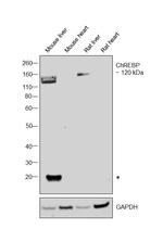 ChREBP Antibody in Western Blot (WB)